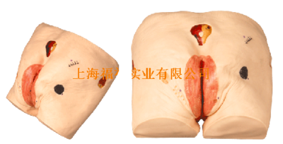 高级压疮（褥疮）护理模型